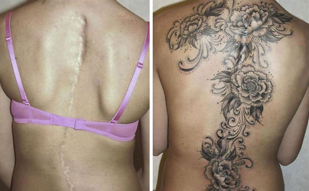 scars-tattoo-cover-up-34-590b1c5a29fab__605