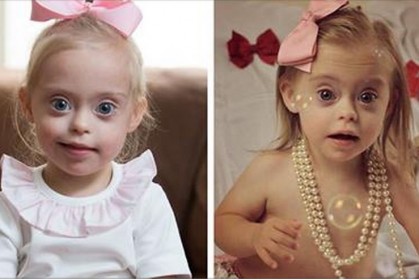 年僅2歲的可愛小女孩已是個模特兒，令人驚訝的是，她居然是名唐氏症患者～