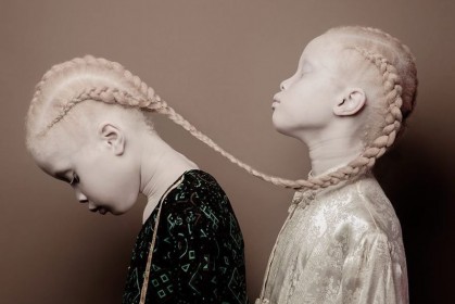 來自巴西的「白化症雙胞胎」，其獨一無二的美感在時尚界掀起巨大關注
