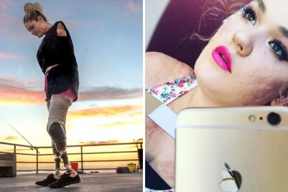 女子因得了「罕見疾病」失去四肢皮膚爛掉，現在她在網路上教人化妝爆紅感動世界！