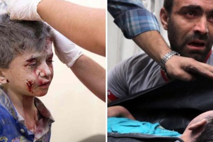 攝影師鏡頭下13張「敘利亞2天200次空襲」的兒童受害照片，世界悲慟！