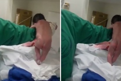 這名小嬰兒剛出生就想要「站起來走路」，在場的護士跟醫生都嚇壞了...
